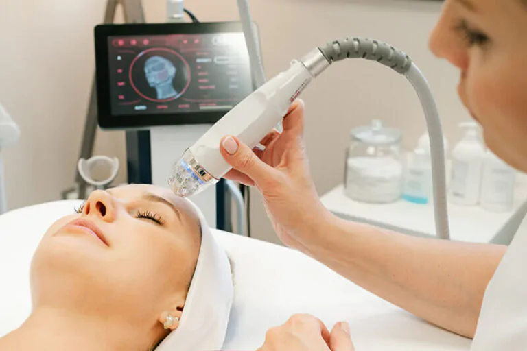 Radiorefraktiv Micro-needle Rf Lifting uden skalpel